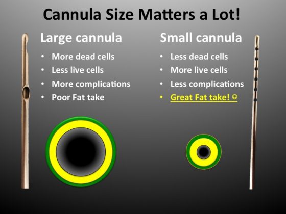 An illustration showing how cannula hole size matters to the longevity of the fat graft.