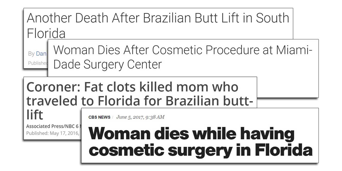 screenshots of four recent headlines from articles about patients dying after brazilian butt lift surgery