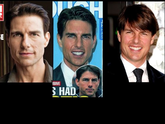 Several photos of Tom Cruise which makes one wonder: "Did Tom Cruise have Plastic Surgery?"