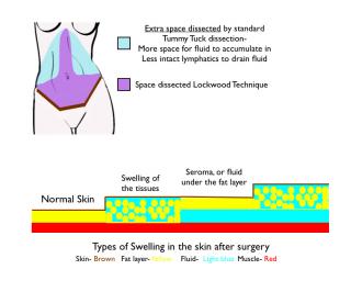 An illustration showing postoperative swelling stages.