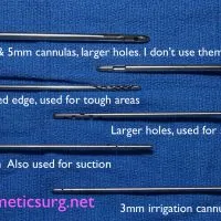 Different liposuction cannulas.