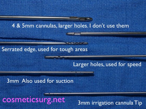 Different liposuction cannulas.