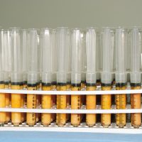 A rack of syringes containing extracted fat.