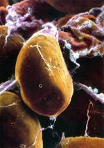 microscopic photo of Lipid droplets