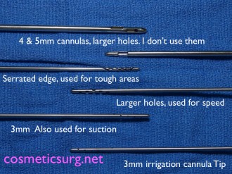 Different liposuction cannulas.