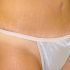 Tummy Tuck scar is placed in panty line