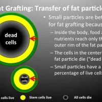 An illustrating showing the reasons why small particles are better for fat grafting.