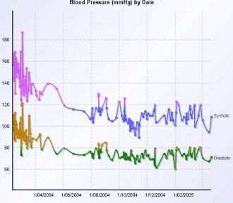 A chart showing blood pressure over time, as measured by an iWatch.