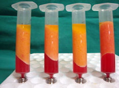 Centrifuged fat from Liposuction.