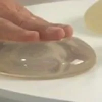 A hand pressing down on a implant on a table.