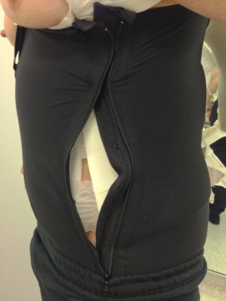 A patient wearing a compression Garment after a Tummy tuck procedure.