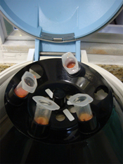 Lipoaspirates being centrifuged.