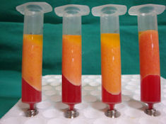 The different layers issued from the centrifuged lipoaspirates.