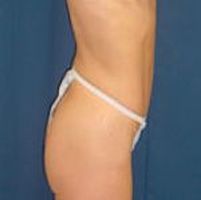 A side view photo of a woman's body, showing a flat stomach.