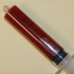 Fluid collection from a seroma.