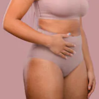 Woman wearing a nude compression garment after tummy tuck and Brazilian butt lift surgery, gently holding her abdomen.