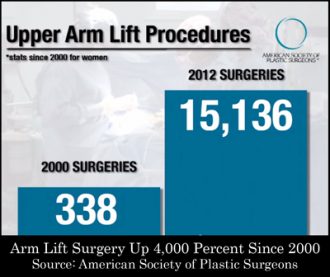 Arm lift surgery on the rise - 2012 statistics.